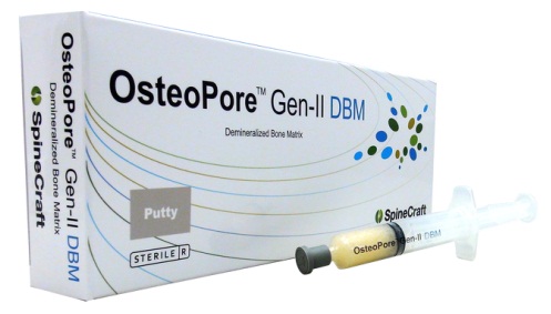 OsteoPore Gen-II DBM